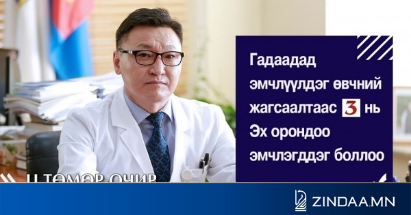 feature-image