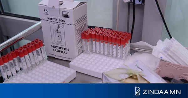 Эмя-ны буруугаас болж 106 сая төгрөгийн pcr-ын урвалжийг устгалд оруулсан уу!